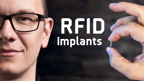 american rfid chip implant|Everything You Need To Know Before Getting An RFID Implant.